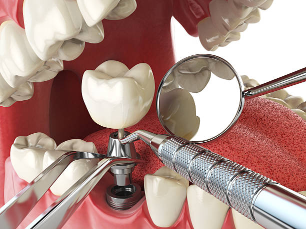 Best Emergency Dental Care for Sports Injuries in North Randall, OH
